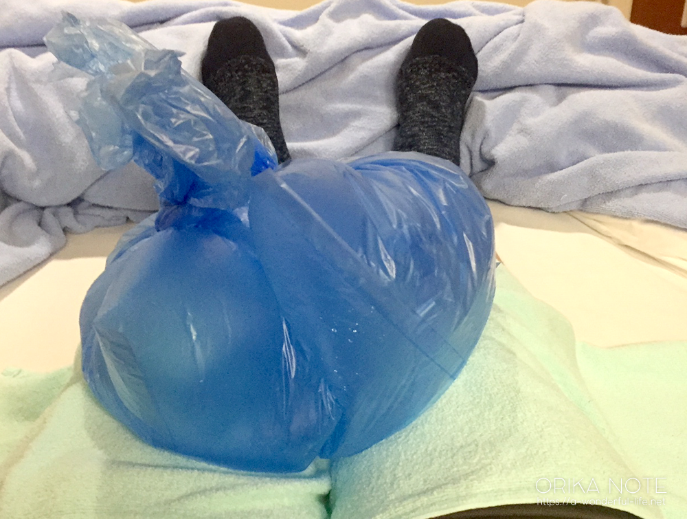 術後6日目｜反復性膝蓋骨脱臼の内側膝蓋大腿靭帯(MPFL)再建術
